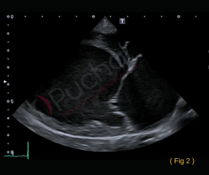 Soplo en perros: ecocardiográficas