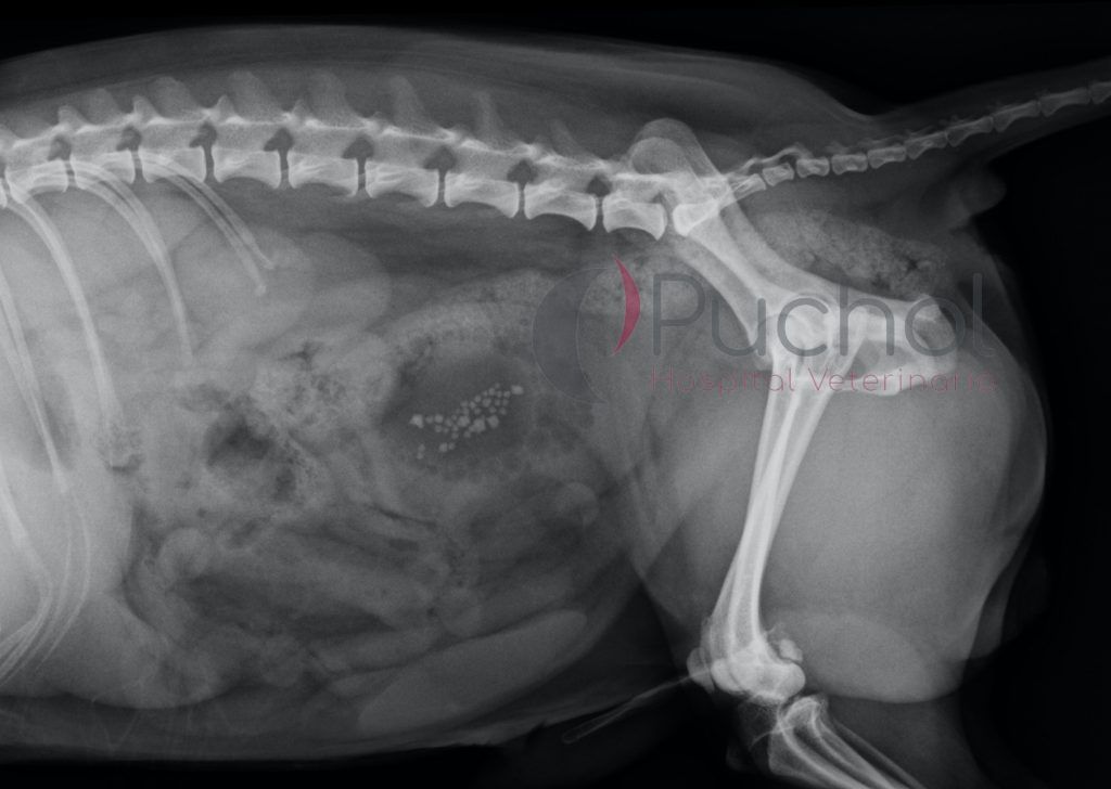 Radiografía de cálculos en vejiga