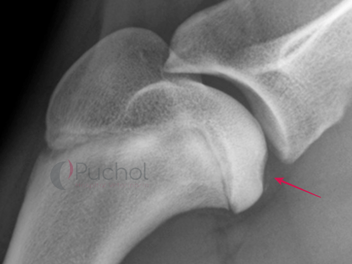 Osteocondrosis del hombro | Cojera en perros