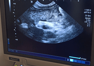 ecografia pancreatitis perro