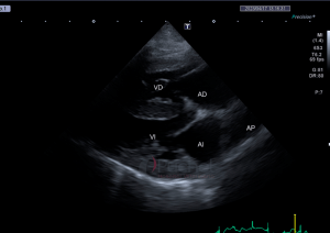ecocardiograma de perro con fibrosis pulmonar