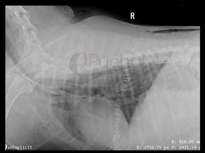 Rx postquirúrgica de toracotomía.