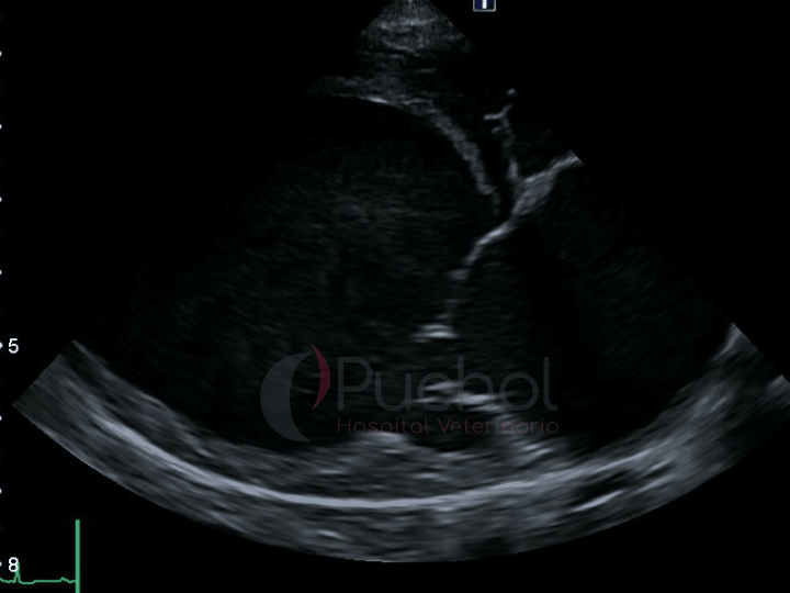 imagen de ecocardiografía de paciente con enfermedad cardioaca