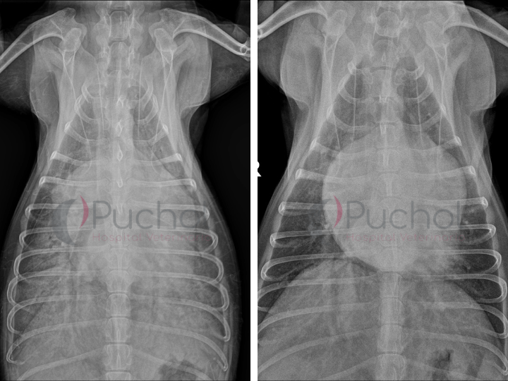 Paciente con cardiomegalia severa