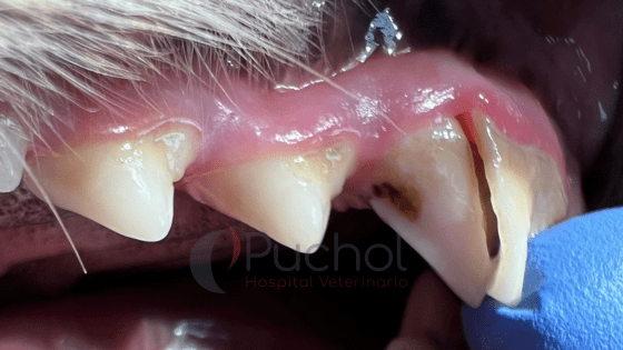 fractura dental por ingesta de piedras