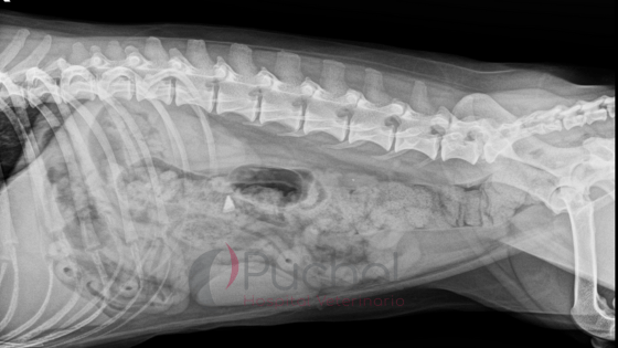 radiografia piedra intestino